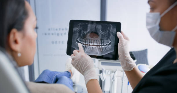 Licensed Dental Implants service in Buellton, CA - Smile Center Dentistry