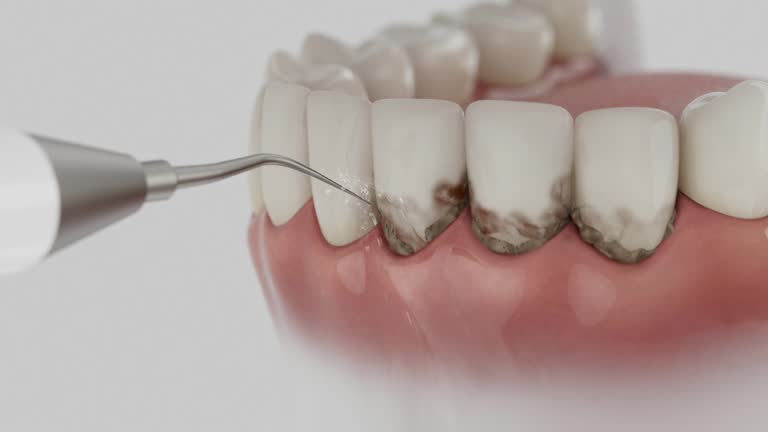 Reliable Dental Implants contractor in Buellton, CA by Smile Center Dentistry